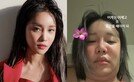 랄랄, 얼굴에 무슨 짓을…“사기 행각” 환골탈태 고백
