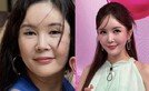 장영란, 2년 전 사진에 ‘충격’…이 정도 비주얼이었어?