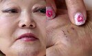 이혜정, 멍투성이 얼굴+몸…대체 무슨 일