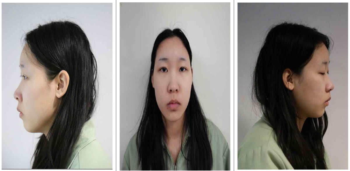 Police release identity in drugged drink killing